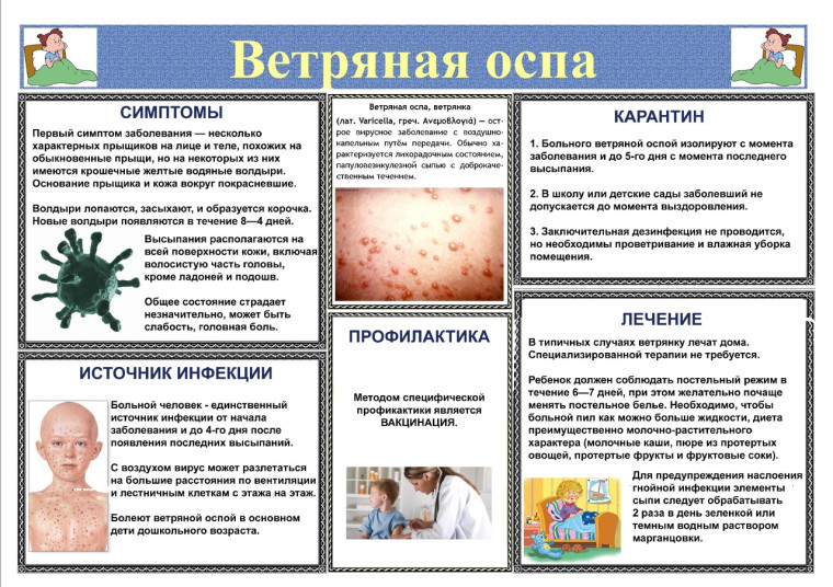 Ветряная оспа. Профилактика.